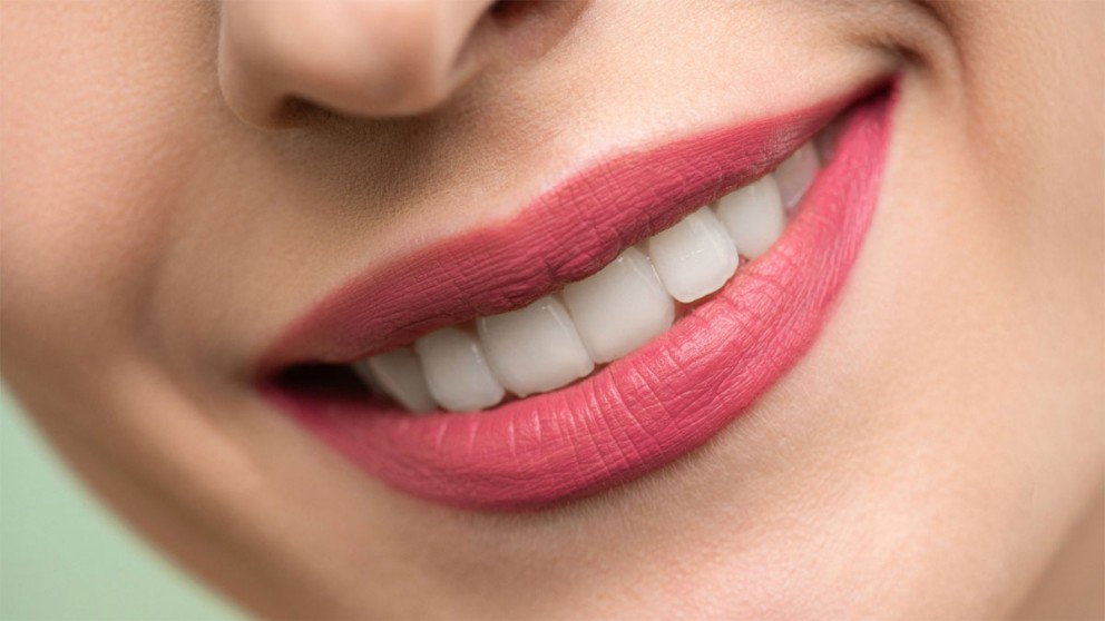 Denti bianchissimi con lo sbiancamento professionale