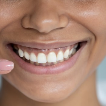 Nemici dello smalto dentale